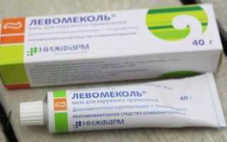 Лечение халязиона без операции
