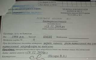 Расшифровка анализов мазка из носа и зева