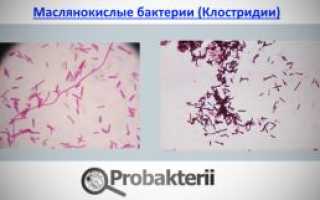 Презентация работы «исследование кисломолочных продуктов на наличие живых бактерий»