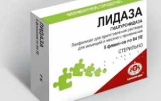 Ронидаза : инструкция по применению