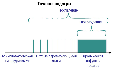 Антуран