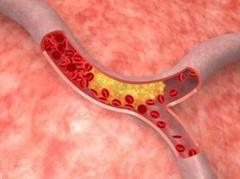 Эволокумаб