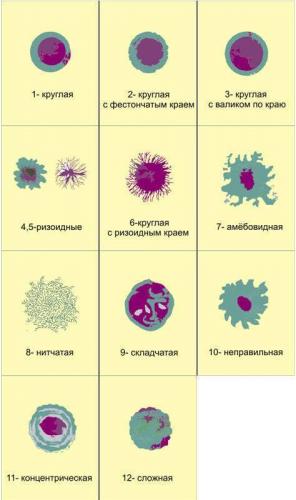 Какие есть формы бактериальной клетки и зачем микроорганизмам такое разнообразие?