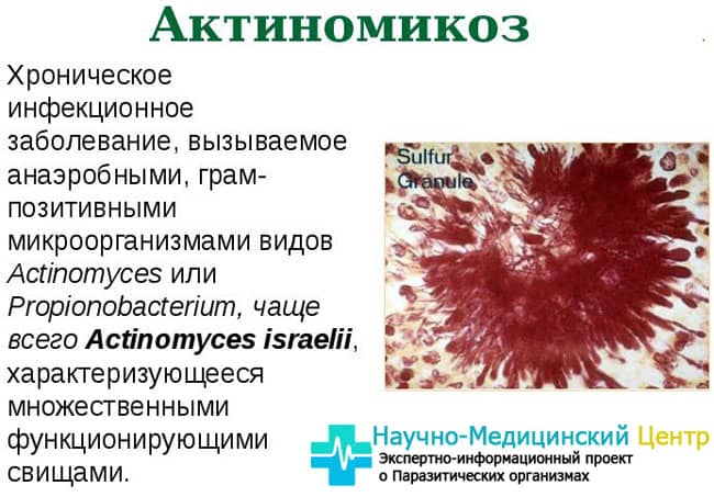 Какие бывают типы или виды бактерий и как их определить