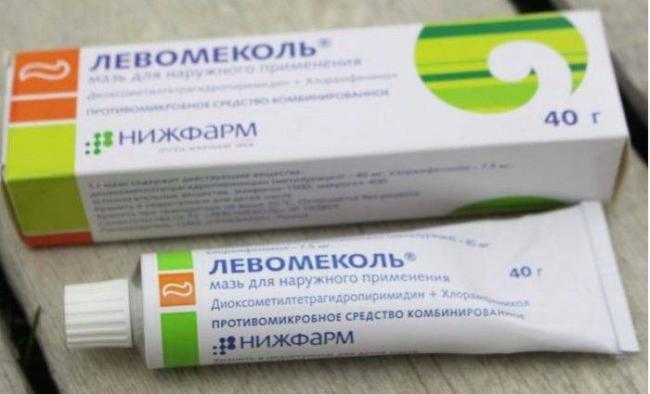 Лечение халязиона без операции