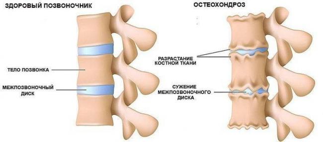 Как правильно спать на ортопедической подушке: подробная информация
