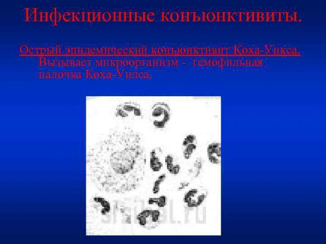 Жизнедеятельность и значение уксуснокислых бактерий