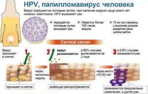 Папиллома на веке глаза: почему появляются и как удалить папилломы на верхнем и нижнем веке