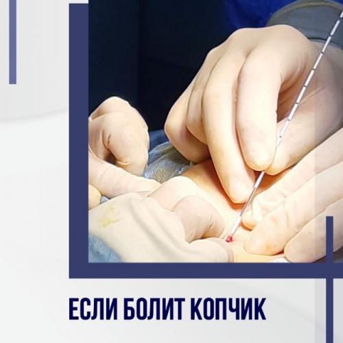 Боль в копчике или в области копчика - причины, характеристика, методы лечения