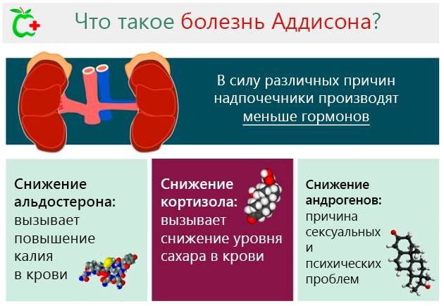 Болезнь аддисона: симптомы, лечение, диагностика, фото, причины