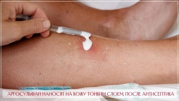 Аргосульфан (argosulfan) мазь. для чего применяется, инструкция, аналоги, цена