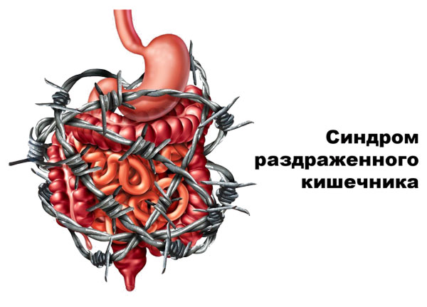 Диета при синдроме раздраженного кишечника