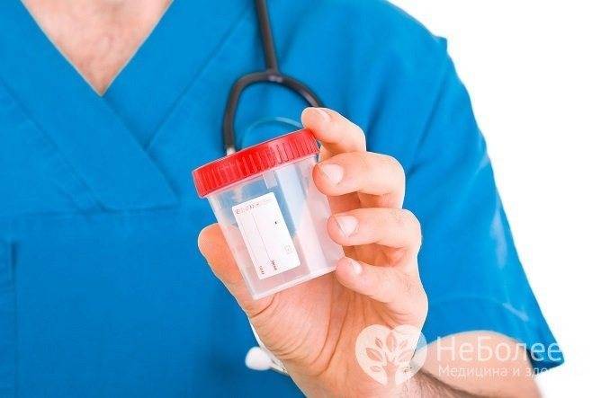 Анализ мочи на бакпосев: что показывает, расшифровка, как сдавать