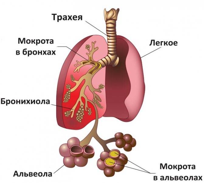 Бромгексин и мукалтин можно принимать одновременно