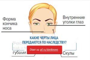 Оттопыренные уши как избавиться без операции. лопоухость — как избавиться от врожденного недостатка