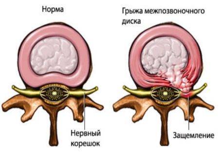 Цель Т уколы инструкция по применению