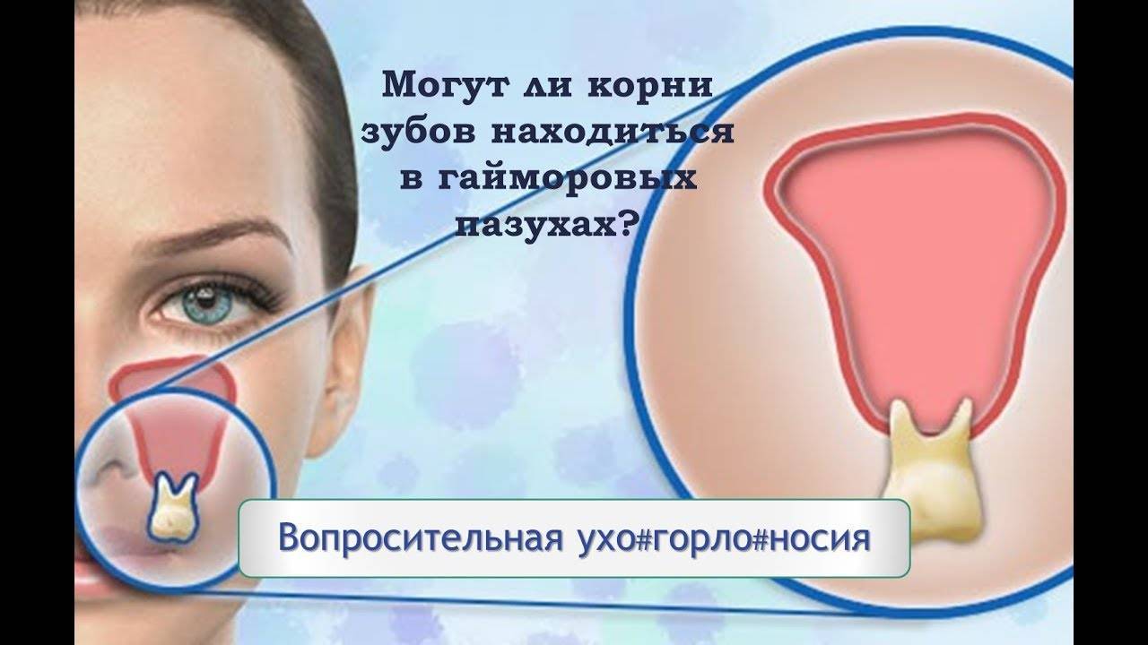 Можно ли при гайморите (синусите) греть нос и лоб в домашних условиях