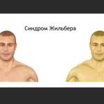 Что за болезнь Синдром Жильбера: диагностика, симптомы, лечение