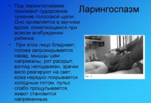 Ларингоспазм. симптомы, первая помощь