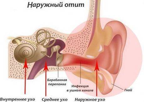 Как применять камфорное масло если болит ухо