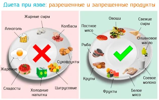 Диета при язве желудка и двенадцатиперстной кишки: стол и рецепты